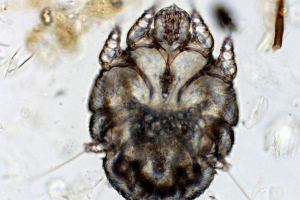Chesoccal tick - rovar cirkál a bőr alatt